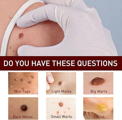 ✨Tags & Moles Remover ( Buy 1 Get 1 Free )✨