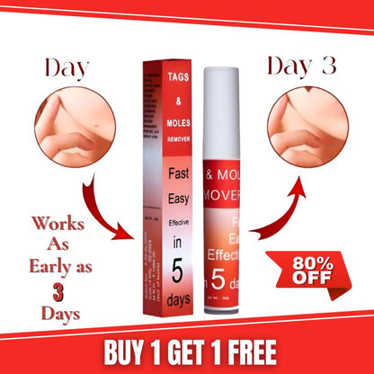 ✨Tags & Moles Remover ( Buy 1 Get 1 Free )✨