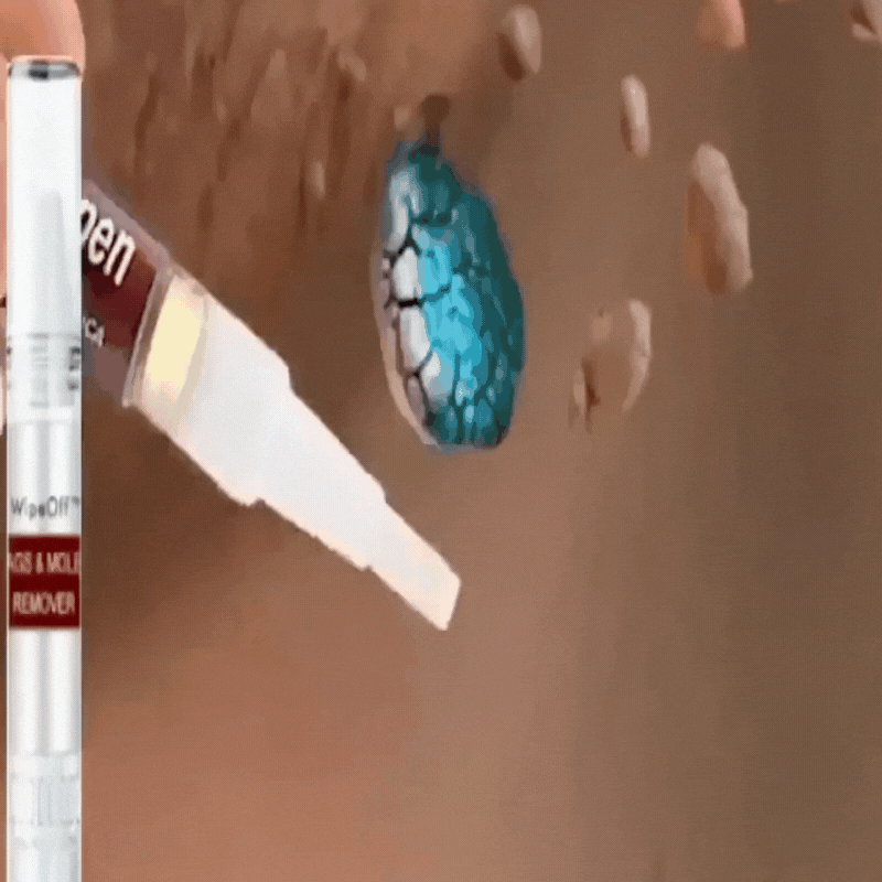 ✨Tags & Moles Remover ( Buy 1 Get 1 Free )✨